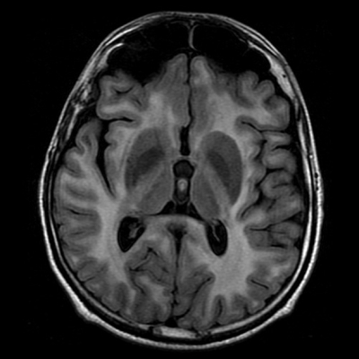 RM Cerebro