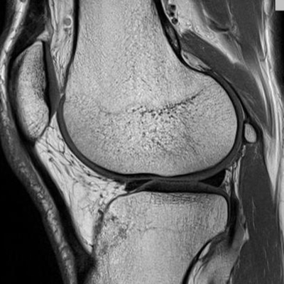RM Rodilla